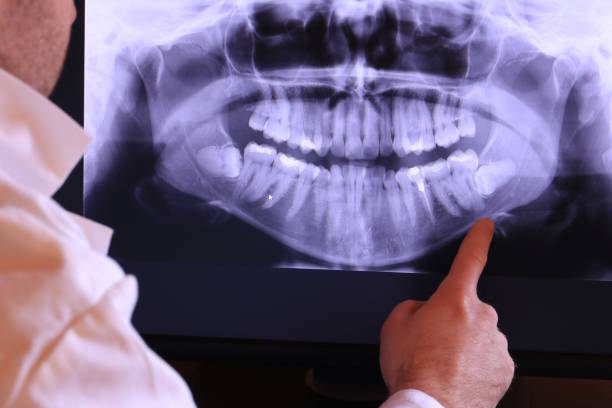 Best Walk-In Emergency Dental Services in Bellevle, IL